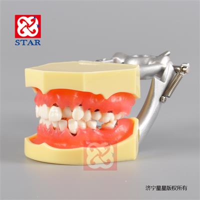 牙周病模型M4003