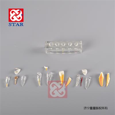 牙髓病治疗模型M4008