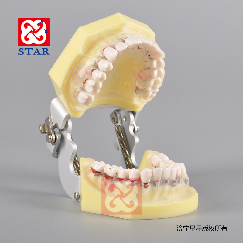 牙周病透明牙龈M4028
