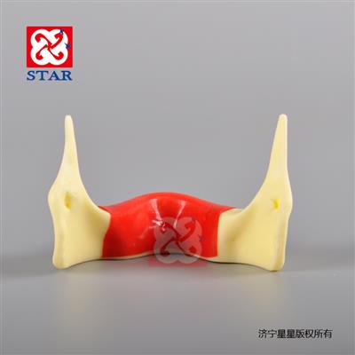 整体硬塑脂缺牙区填充仿骨质定位练习