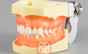 口腔小知识：牙龈出血的原因及预防