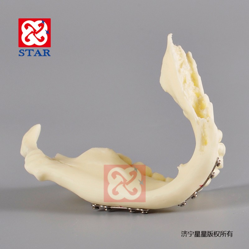 下颌骨M5001