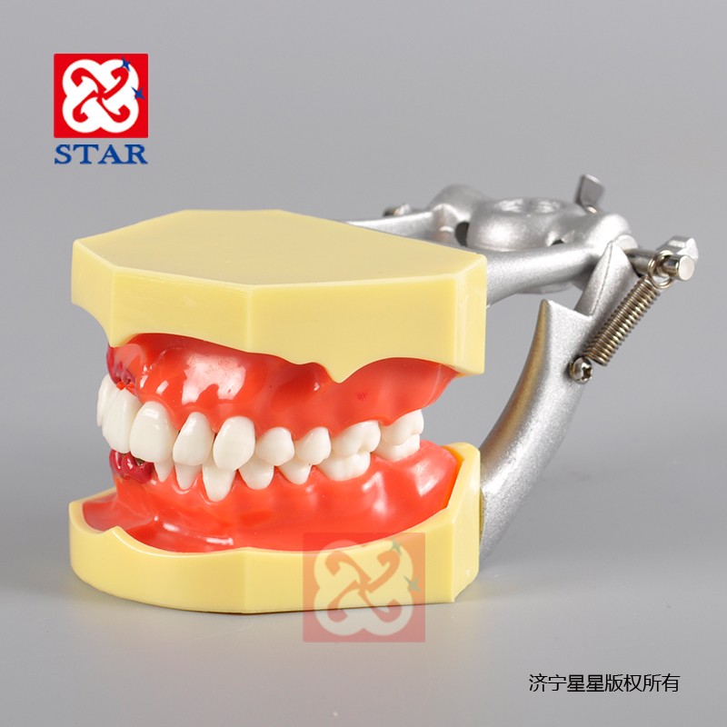 牙周病M4025