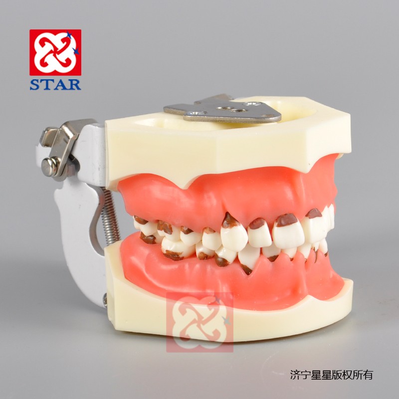 牙周病模型M4024