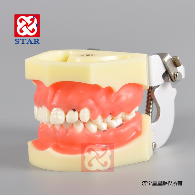 牙周病模型M4023