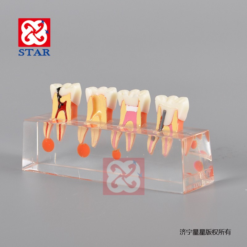 牙髓病治疗模型M4018