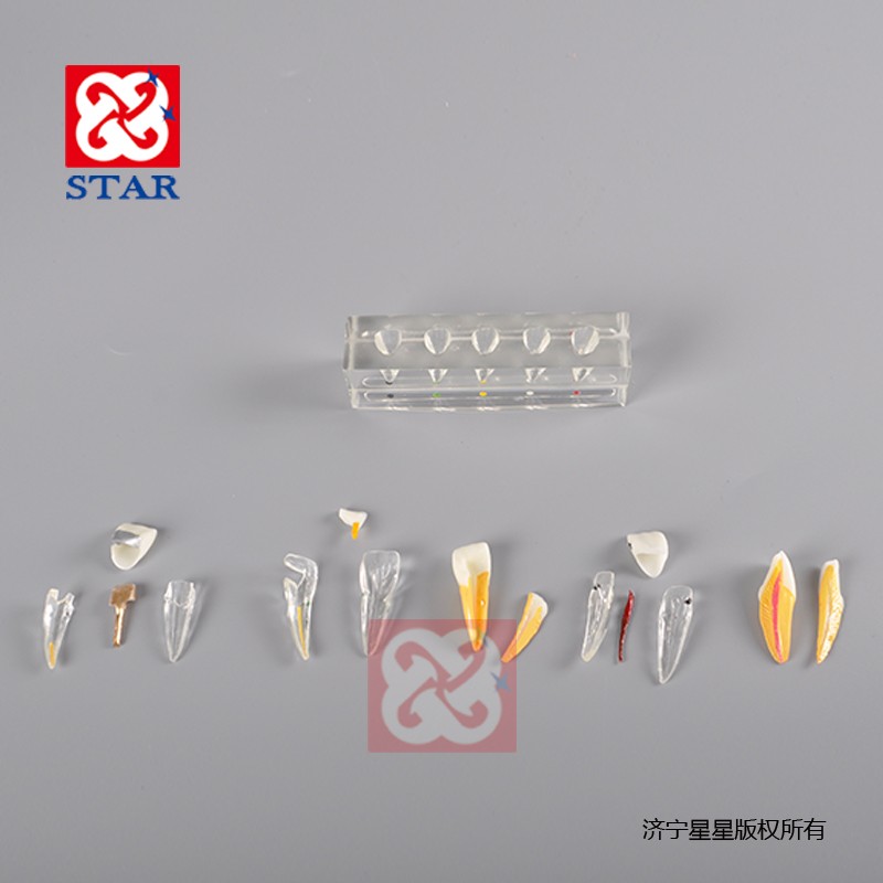 牙髓病治疗模型M4008