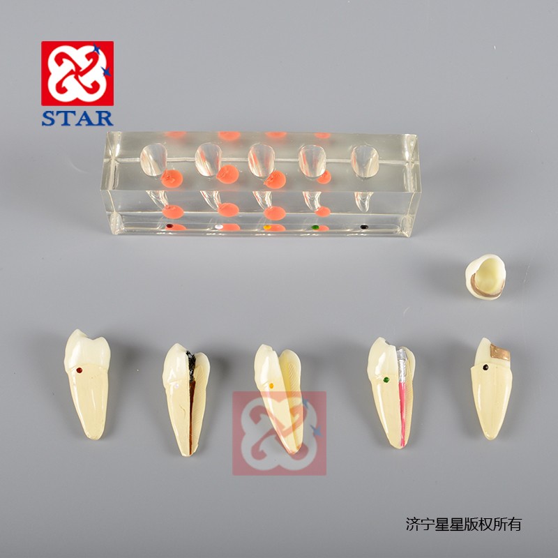 牙髓病治疗模型M4007-2